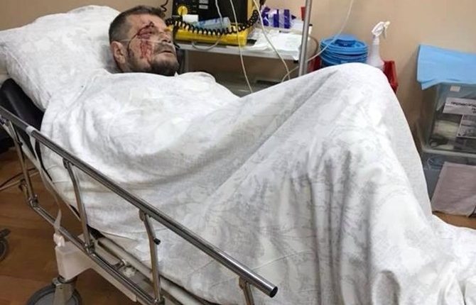 В результате покушения на Мосийчука один человек погиб и четверо ранены